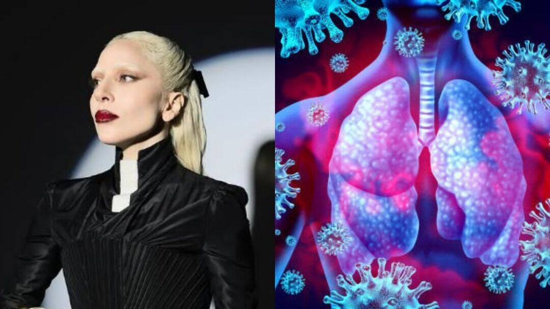 Lady Gaga cancels tour due to worsening respiratory infection