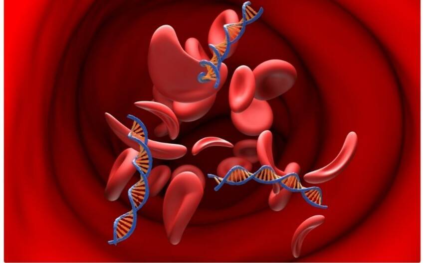 Bone Marrow Transplant is life-saving for blood disorders: Expert