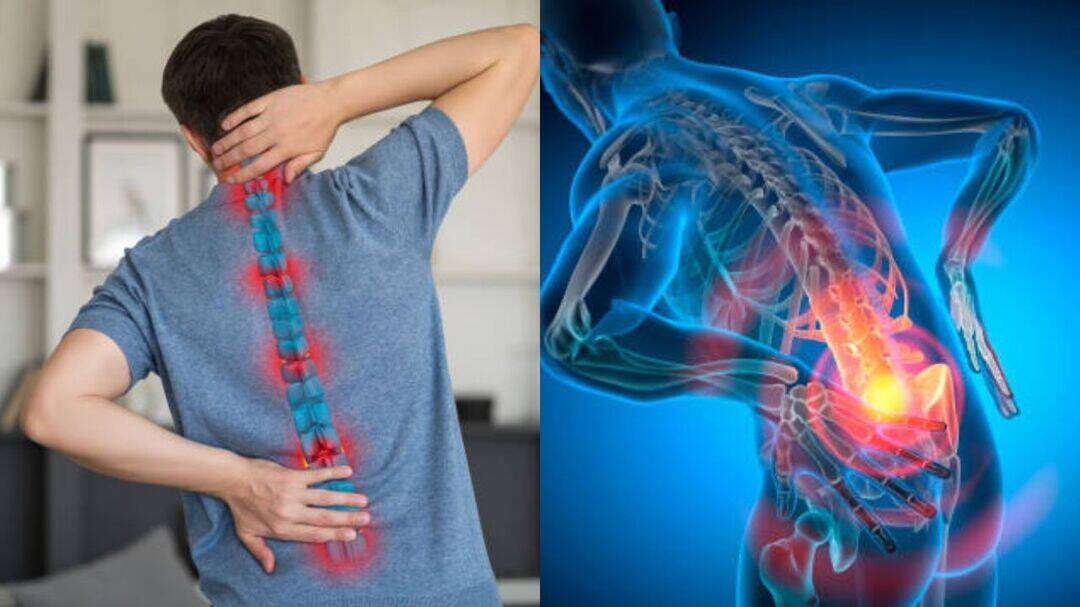 Painful slipped disc symptoms you shouldn’t ignore