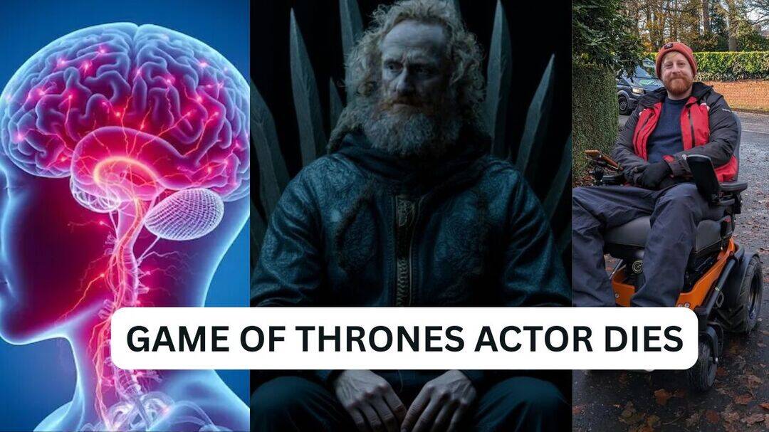 What is MND that killed GOT actor Michael Patrick at 35?