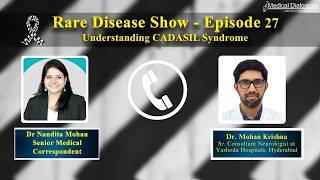 Expert explains CADASIL syndrome and how it affects the brain