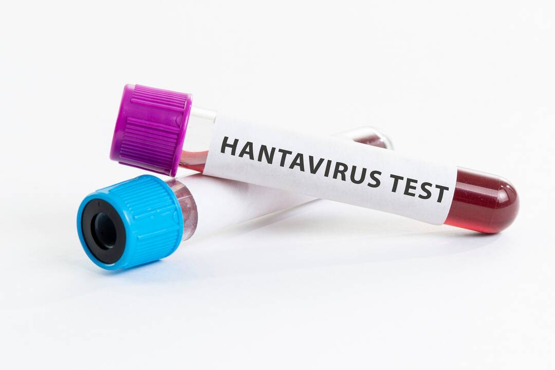 Experts urge vigilance, say hantavirus risk to India remains low