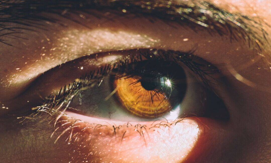 Yellow eyes may be an early sign of liver problems