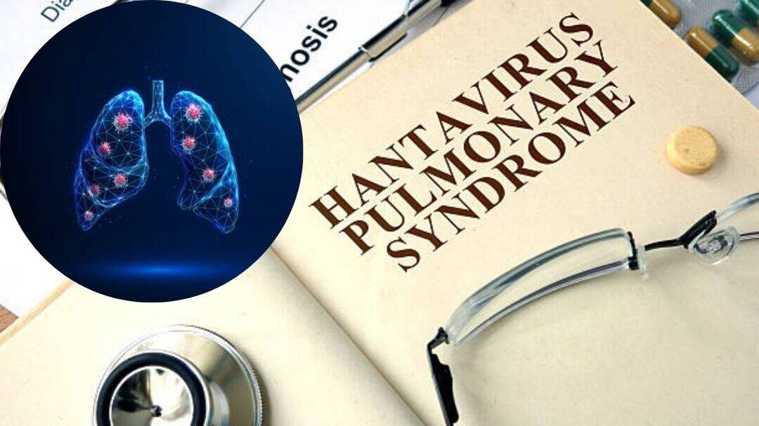 Hantavirus Pulmonary Syndrome(HCPS) turns deadly fast
