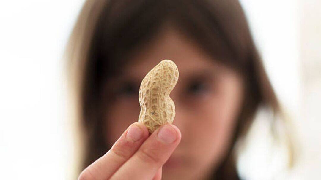 Peanut therapy helped 82% allergic kids: Lancet study 