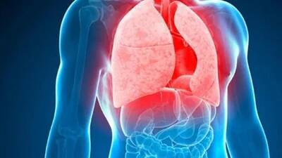 Ending undernutrition can prevent 2.3 mn TB cases globally: Study