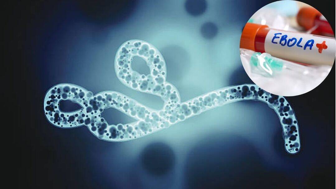 What is the Bundibugyo Ebola strain spreading in Congo?