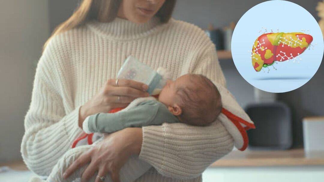 Can formula feeding raise fatty liver risk in children?