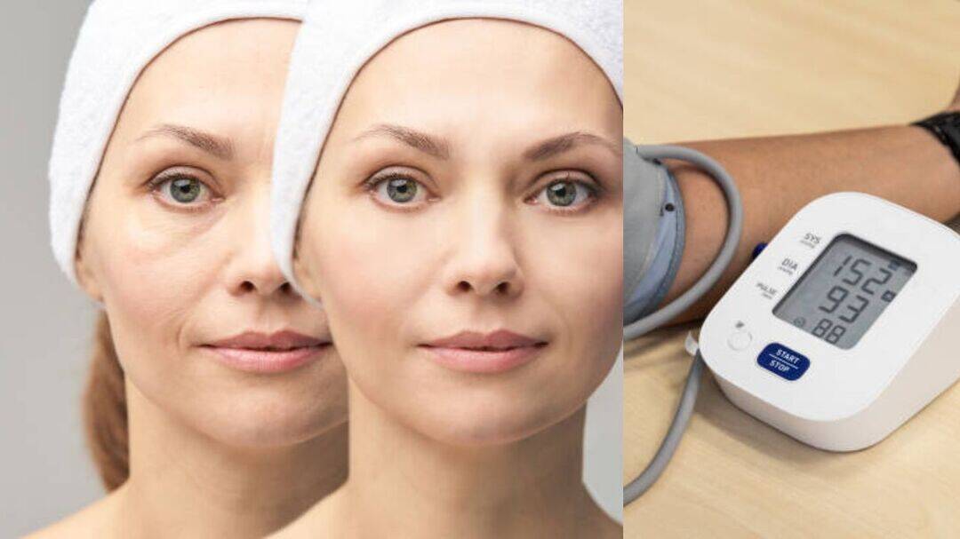 World Hypertension Day: Subtle facial signs that warn of high BP