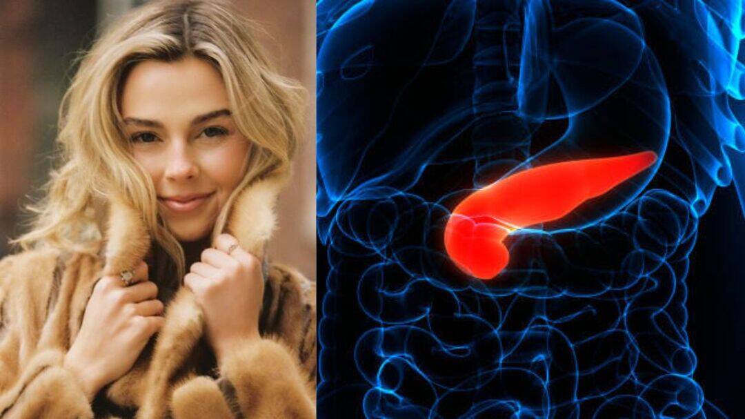 Influencer Sydney Towle shares rare bile duct cancer has spread