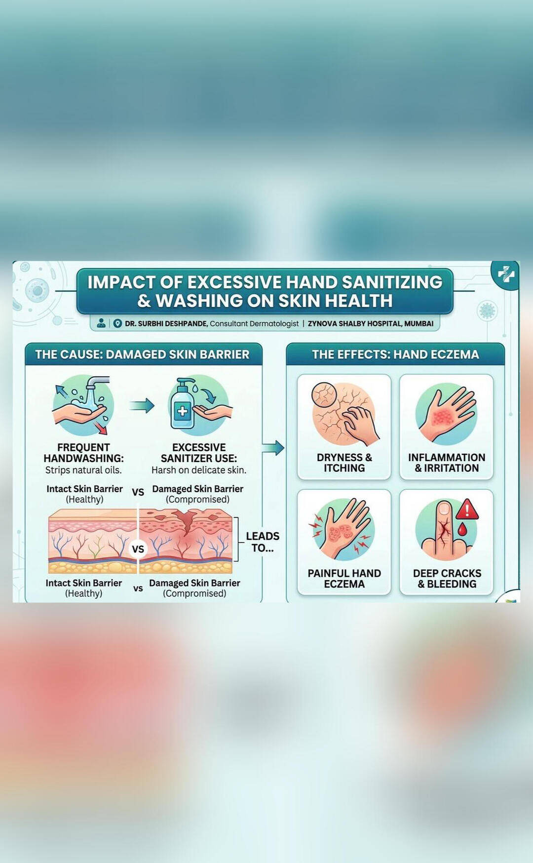 Dermatologist explains what using too much sanitiser can do to one's hands