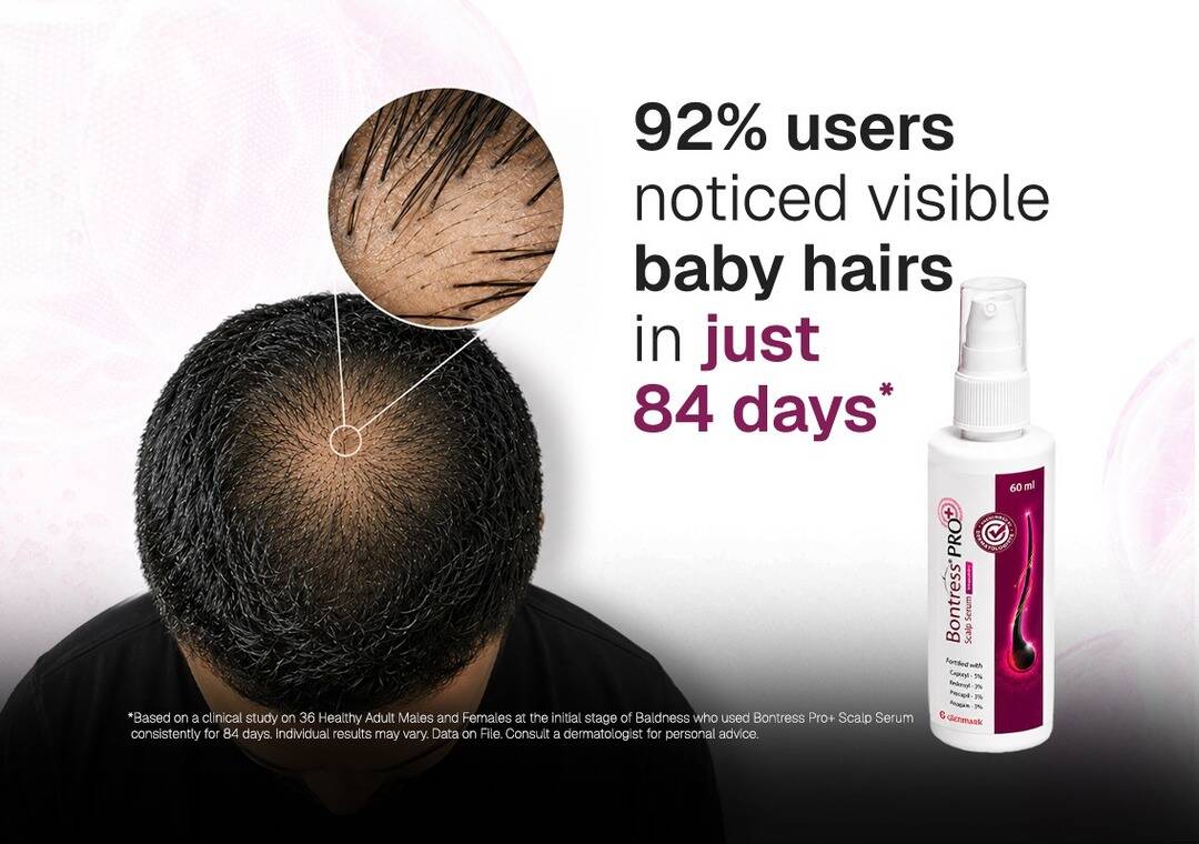 Clinical study shows promising hair regrowth results: Glenmark