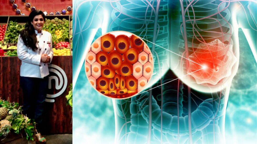 MasterChef Pankaj Bhadouria reveals breast cancer diagnosis