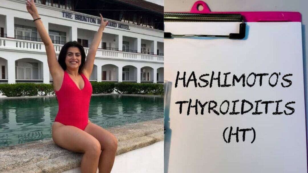Shenaz Treasury opens up about her Hashimoto's diagnosis