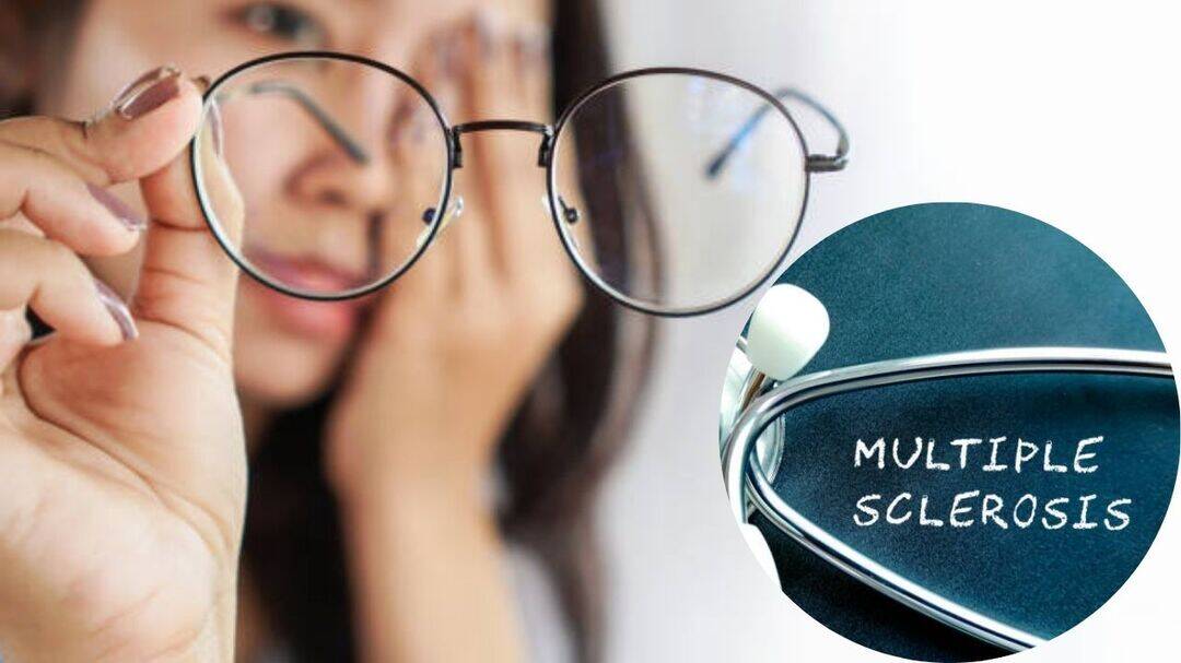 Blurred vision, fatigue may signal multiple sclerosis: Experts