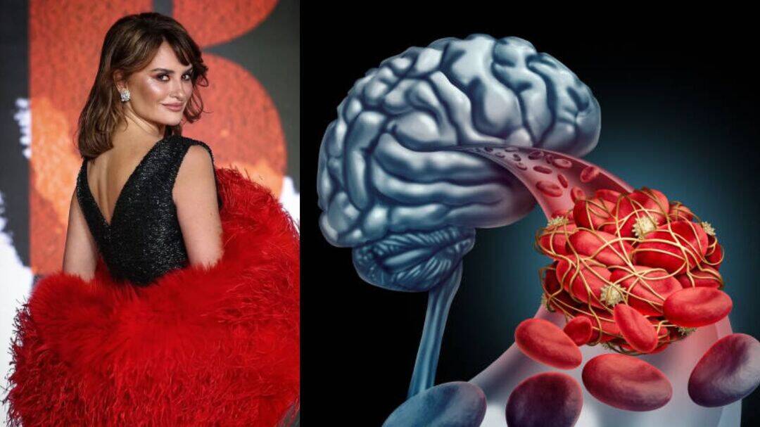 Penelope Cruz reveals terrifying brain aneurysm scare