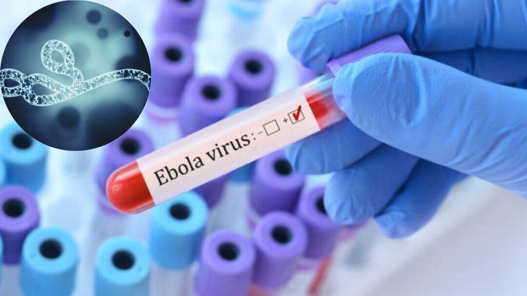 WHO confirms Ebola recoveries amid rare virus outbreak fear