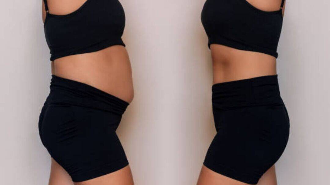 New weight-loss treatments offer hope when diets and exercise fail