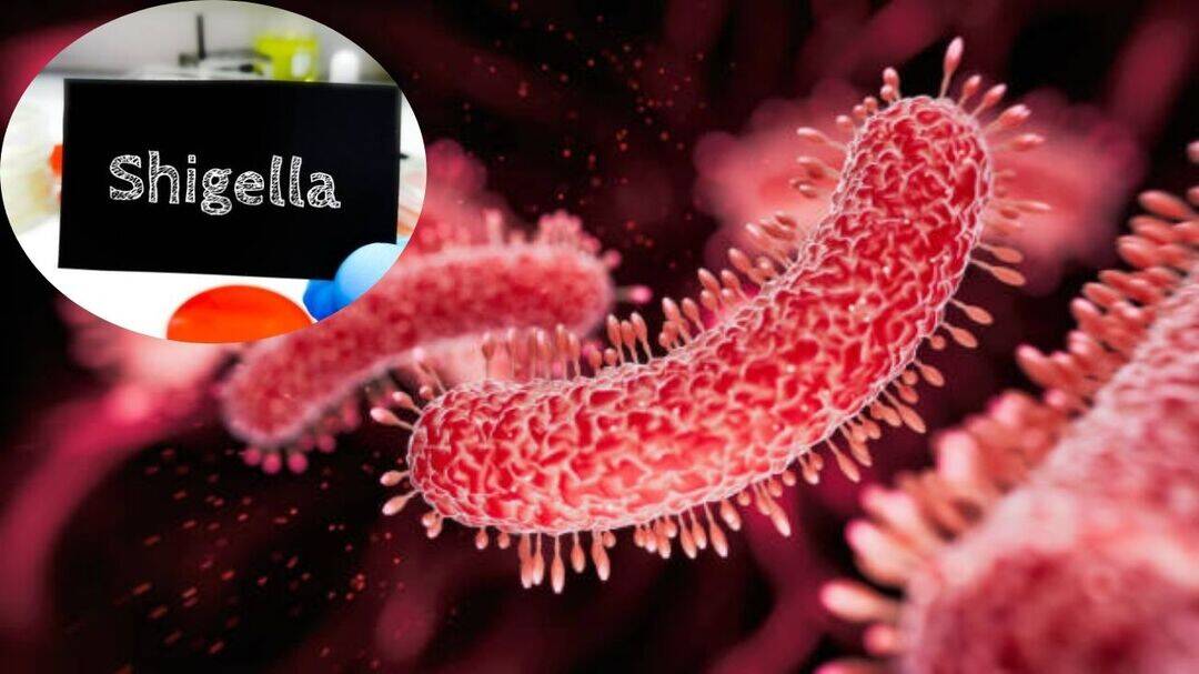 Shigella infection kills 4-year-old in Kerala; Know warning signs 