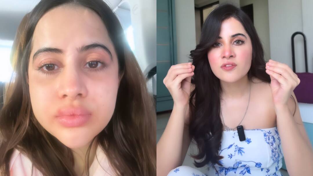 Uorfi reveals real reason behind her viral swollen-face photos