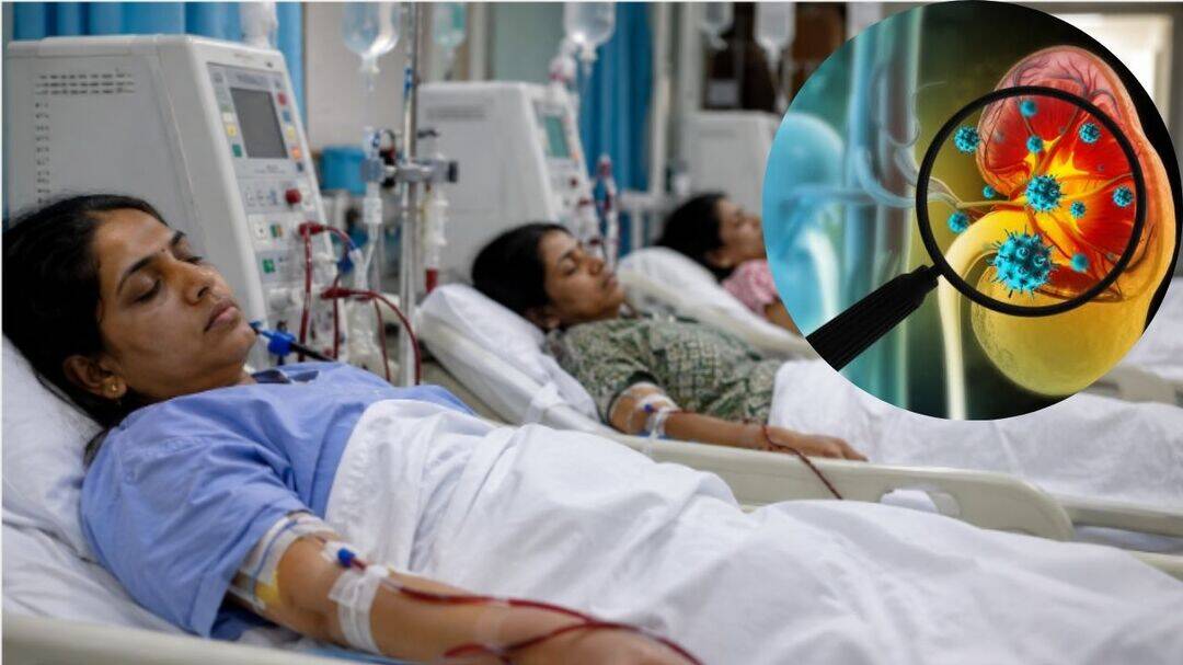 Five mothers develop kidney failure after childbirth in Bikaner