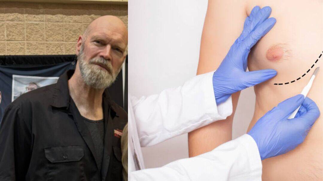 X-Men star Tyler Mane reveals breast cancer, begins chemotherapy
