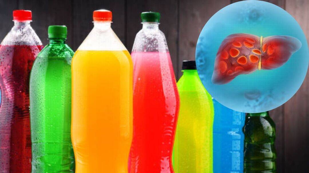 Liver cancer risk linked to sugary drinks, 18-year study finds