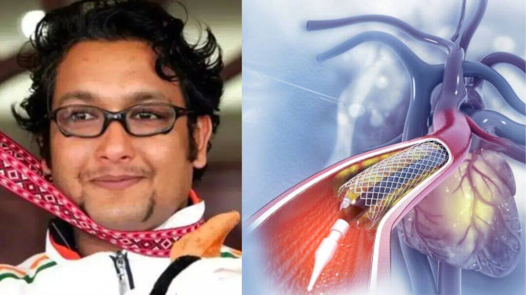 Jaspal Rana death: Can a heart stent fail?