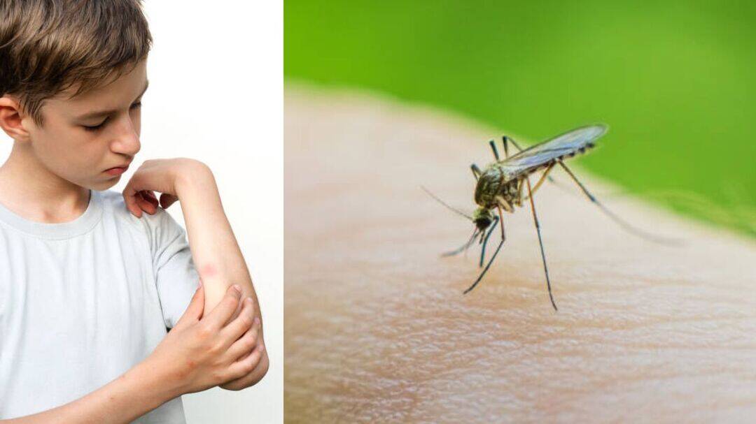 Why mosquitoes bite some people more than others?