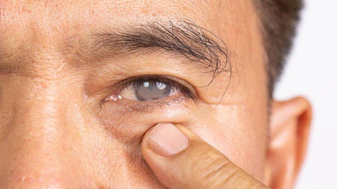 Why waiting for cataracts to mature is a myth?