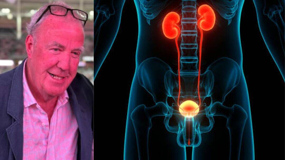 Jeremy Clarkson's reveals aggressive prostate cancer