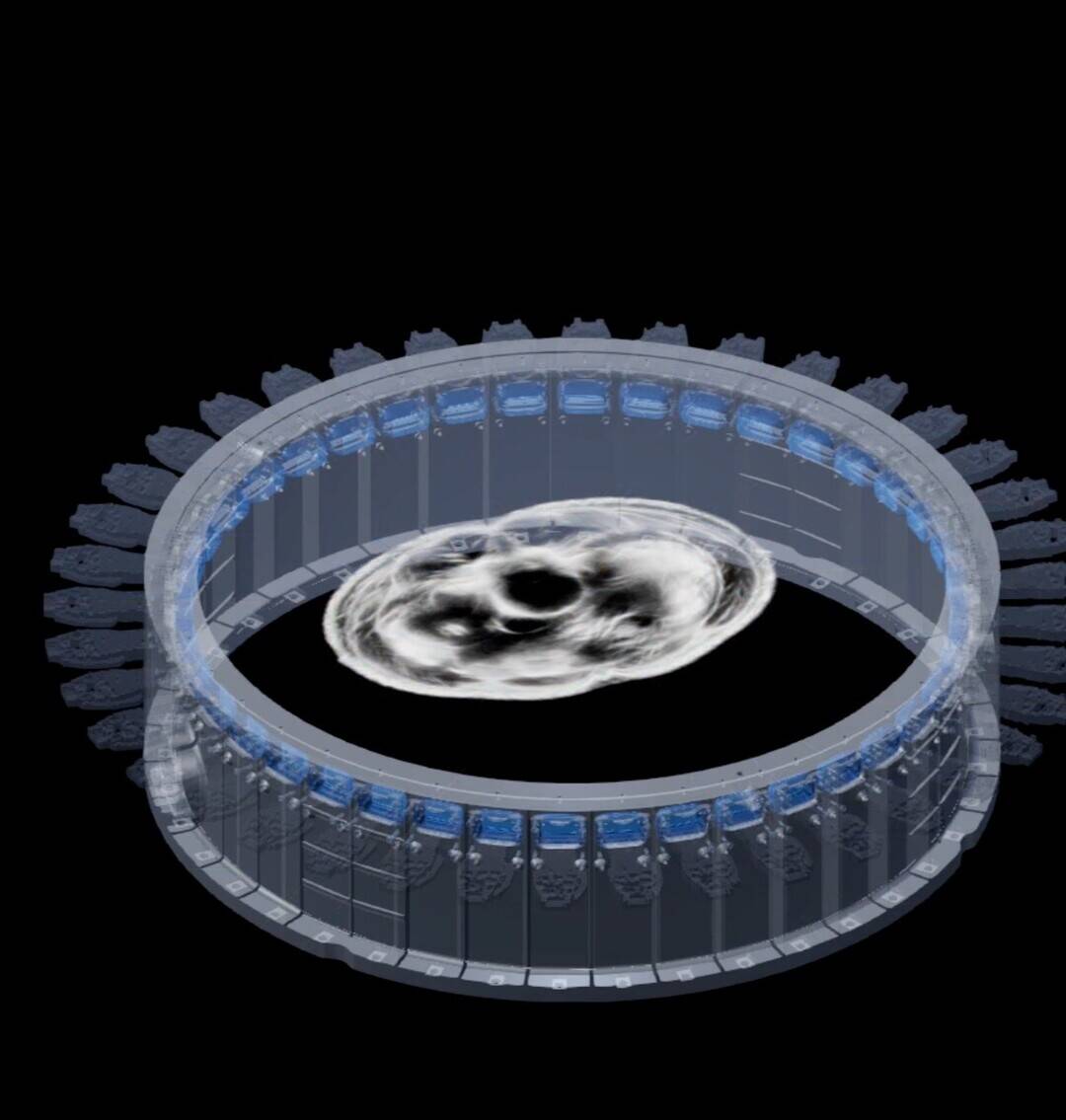 AI startup Midjourney unveils scanner that maps body 100 times faster than MRI, to be housed at spa