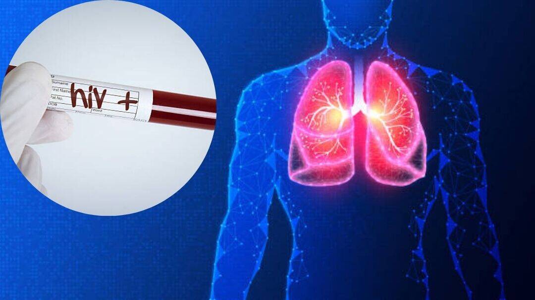 First-ever HIV-to-HIV lung transplant offers new hope