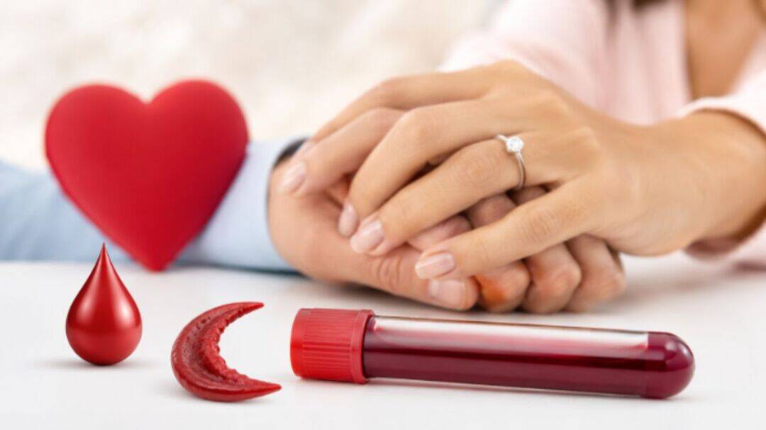 Why every couple should undergo sickle cell test before marriage?