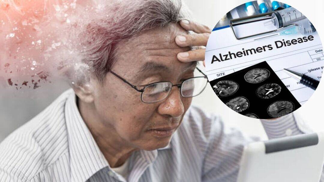 Frequent repetition may signal cognitive decline: Doctors