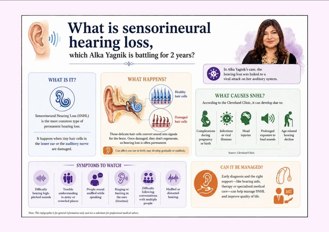 What is sensorineural hearing loss, which Alka Yagnik has been battling since 2024?
