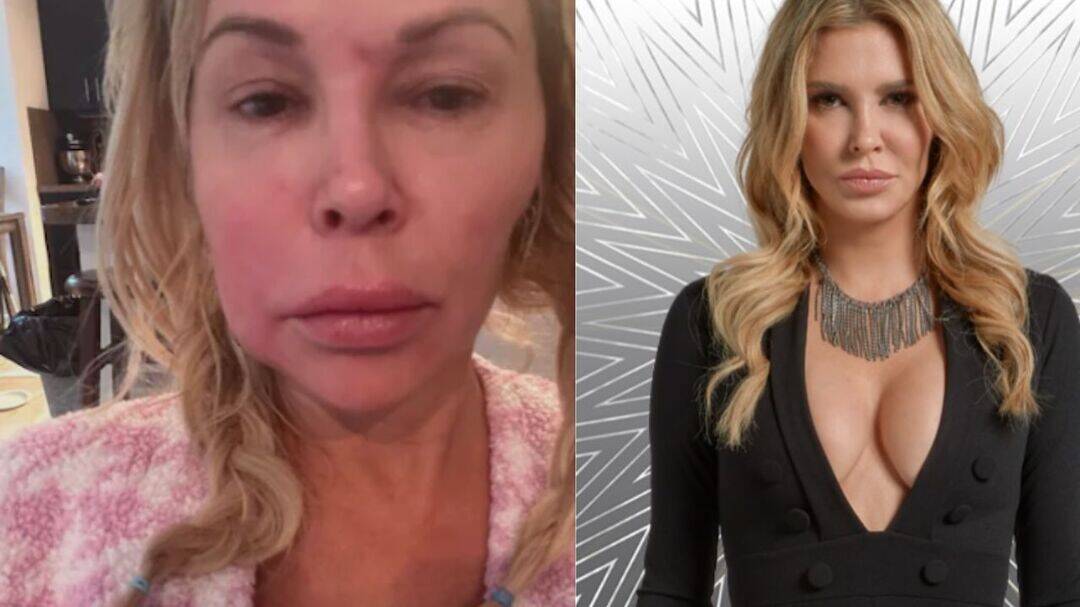 Brandi Glanville reveals benign tumour discovery 