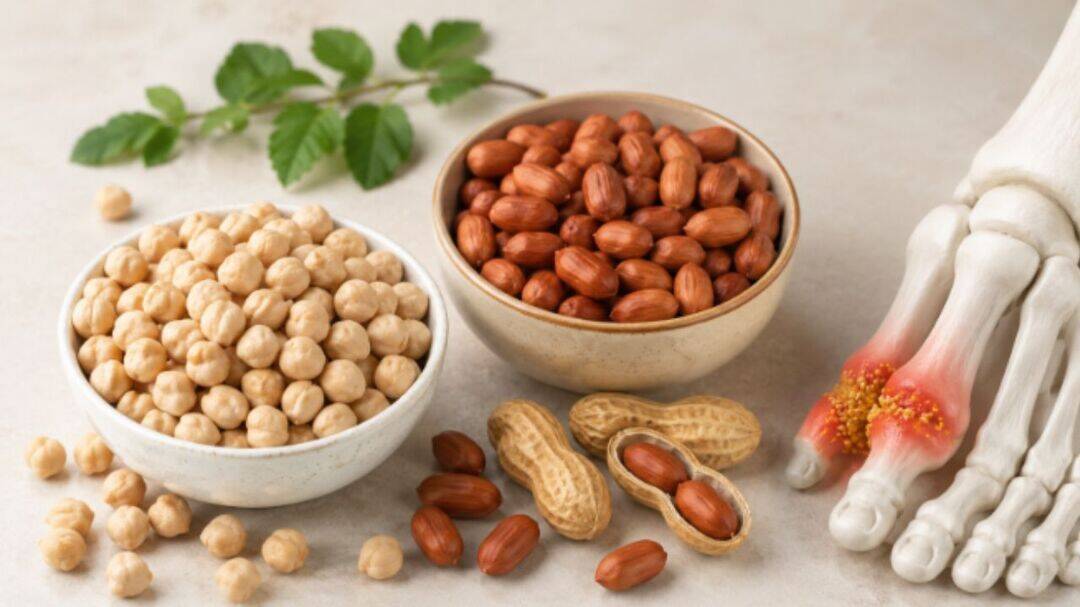 Do chickpeas and peanuts raise uric acid? 