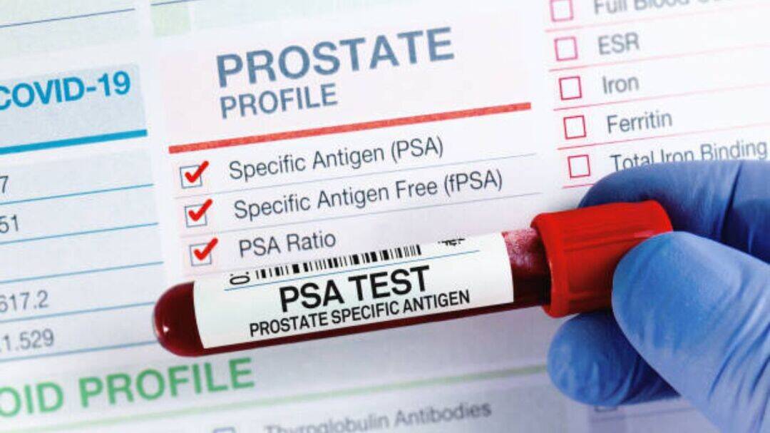 Breakthrough blood test detects aggressive prostate cancer