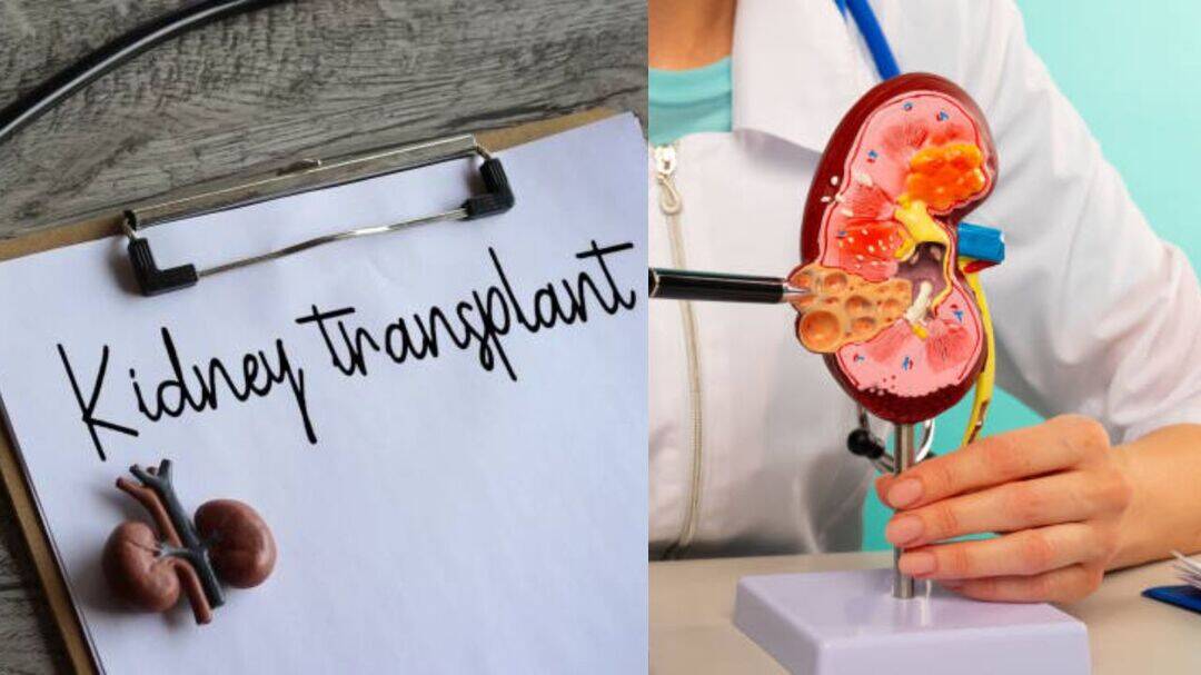 Kidney transplant hospitals to publish survival rates: NOTTO
