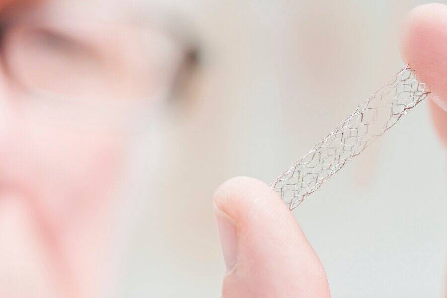 Can a person still have a heart attack after a stent?