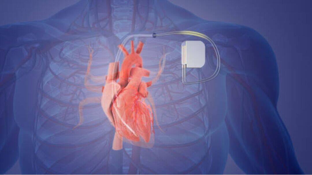 Pacemaker warning signs every heart patient should know 