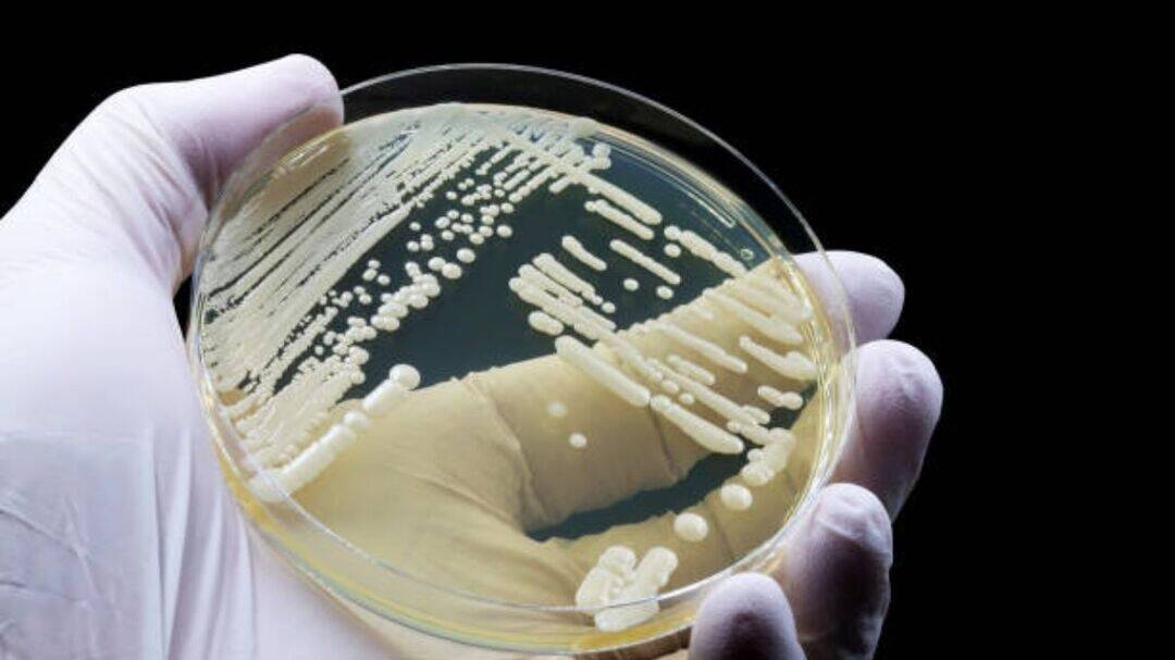Candida auris infections rising in US