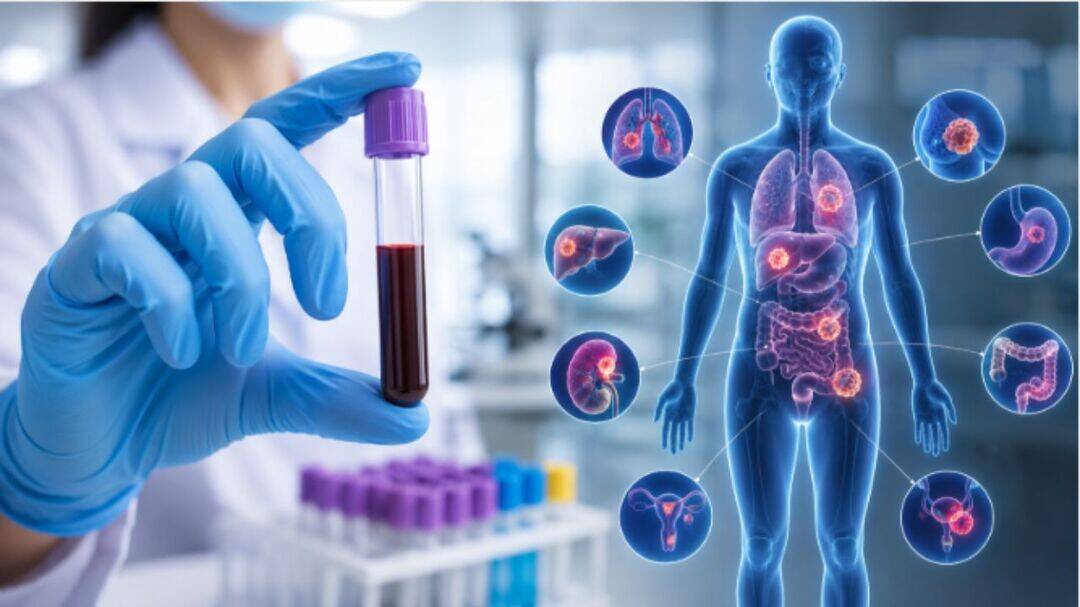 New blood test to screen for 10 common cancers launched in India