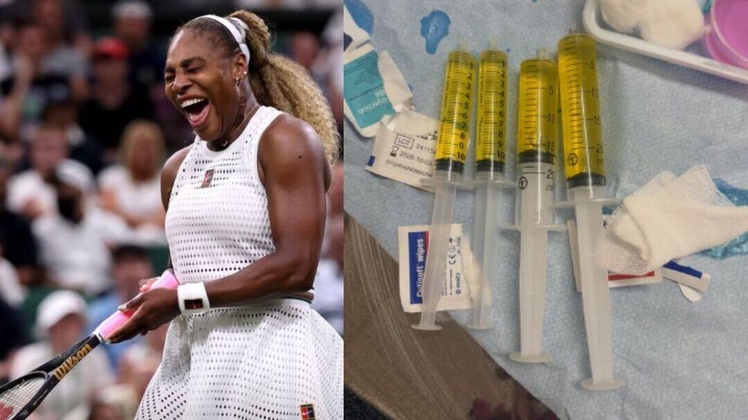 Serena Williams reveals knee effusion after Wimbledon exit