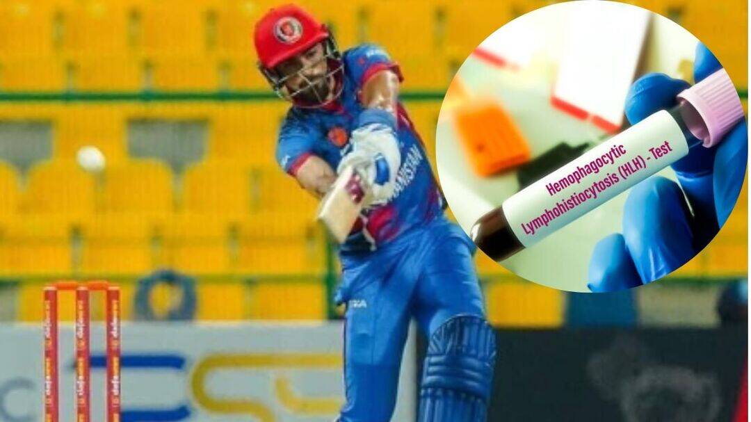 Shapoor Zadran dies at 38 from HLH immune disorder