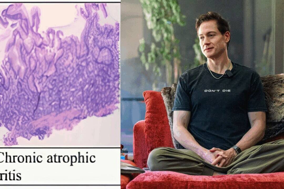 Bryan Johnson to use AI to treat autoimmune gastritis