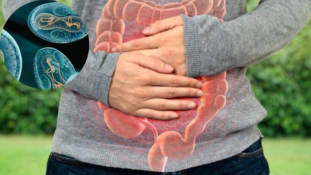 Cyclospora outbreak in US: Symptoms of the diarrhoea parasite