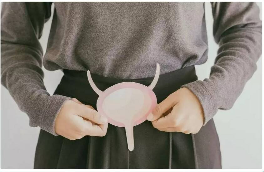 Could these urinary signs point to bladder cancer?
