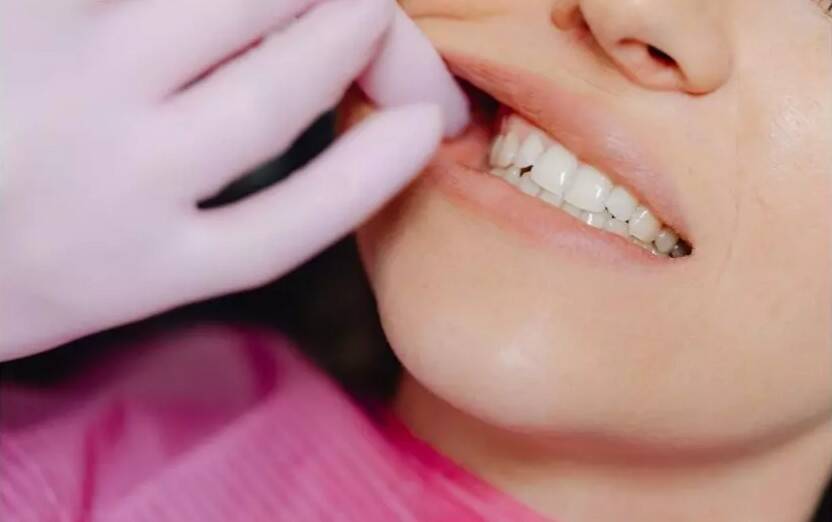 Doctors warn against ignoring oral cancer symptoms